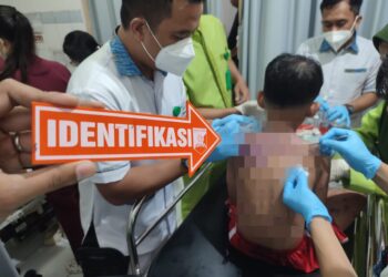Ibu dan Anak di Sukabumi Disiram Air Keras, Polisi Buru Pelaku